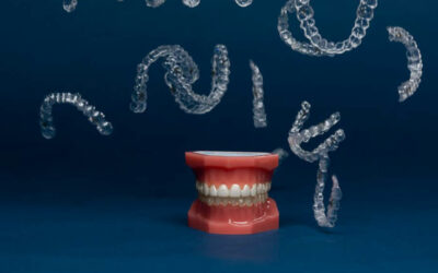 How Long Is The Average Invisalign Treatment?